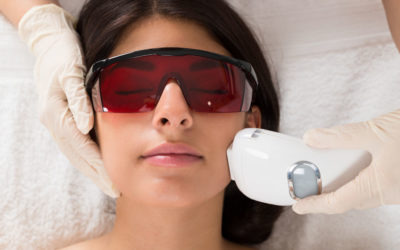 Can Laser Treatment Cause Skin Cancer?