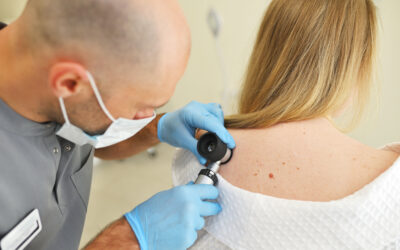 Why Early Detection Is Critical: How Skin Cancer Progresses